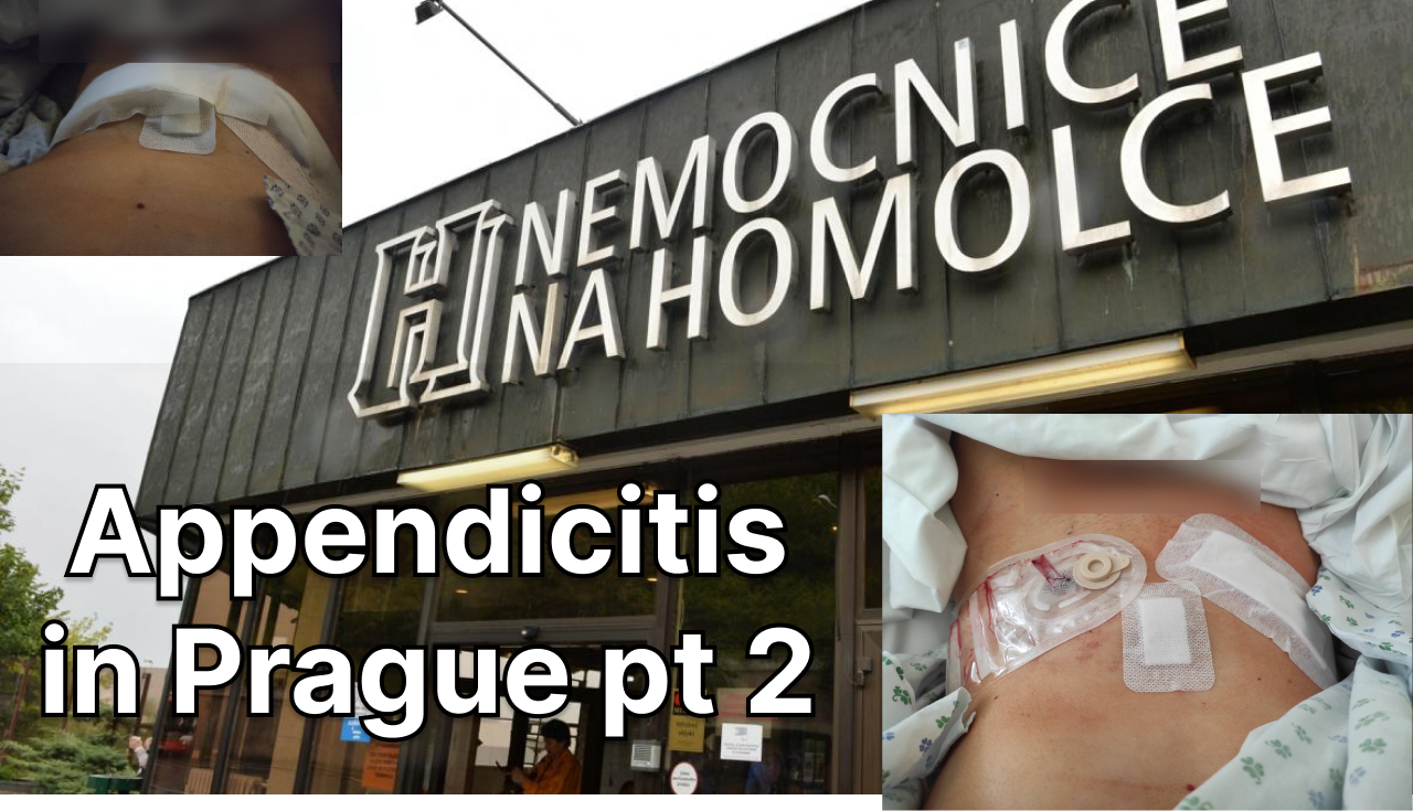 Surgery & health care experience in Prague pt2: appendicitis
